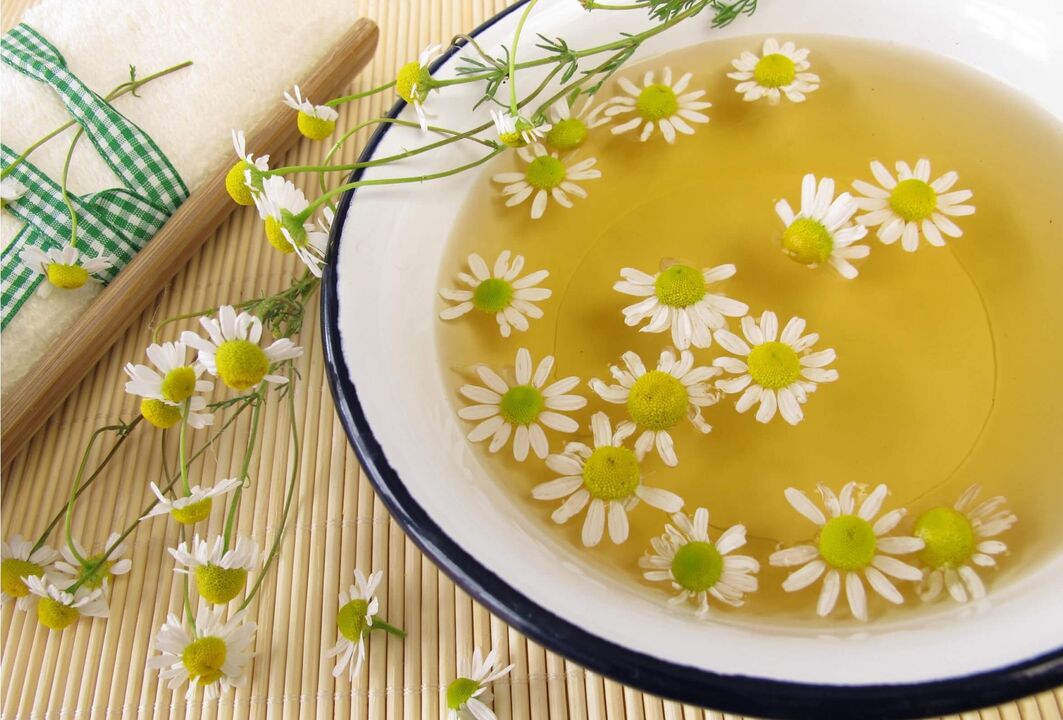 chamomile tea for psoriasis