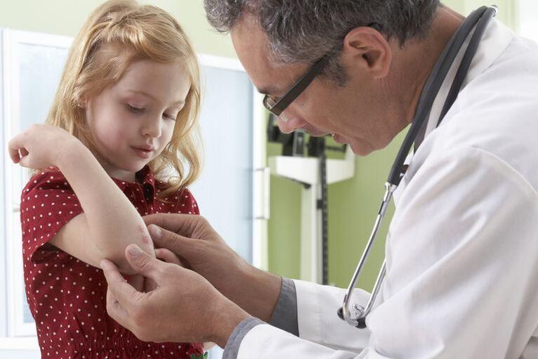 doctors examine children with psoriasis