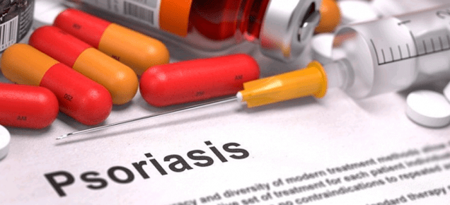 psoriasis medicine